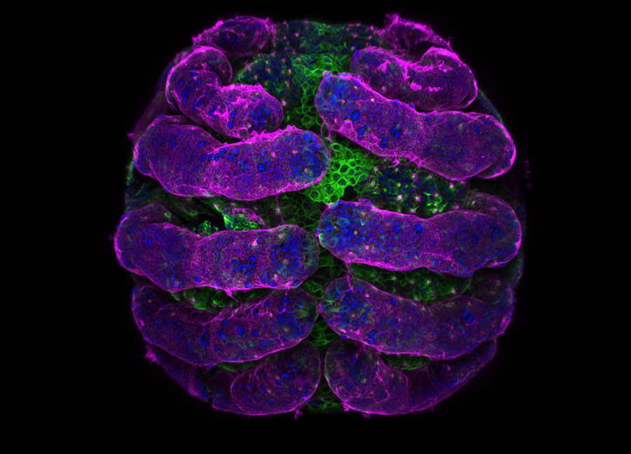 https beautifulnow is discover nature science see astonishingly beautiful winning images of the nikon small world photo competition